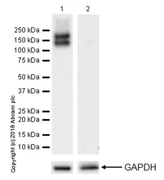Western blot - Anti-Flt3 / CD135 antibody [EPR22232-318] (AB245116), expandable thumbnail