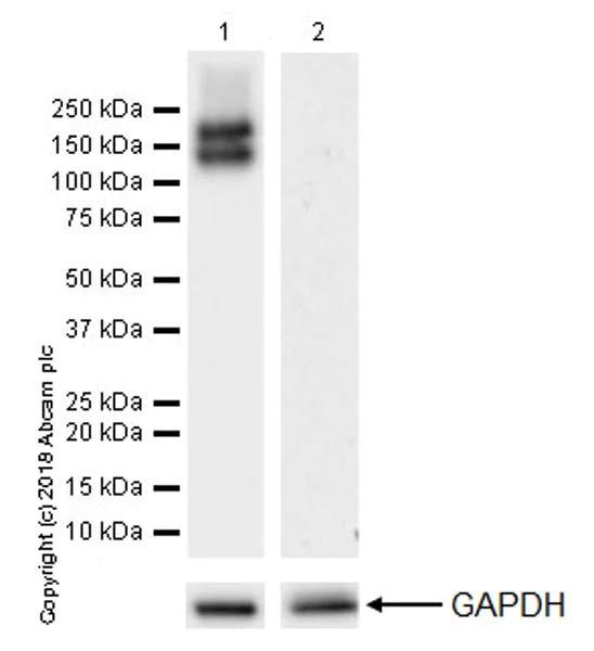 Western blot - Anti-Flt3 / CD135 antibody [EPR22232-318] (AB245116)