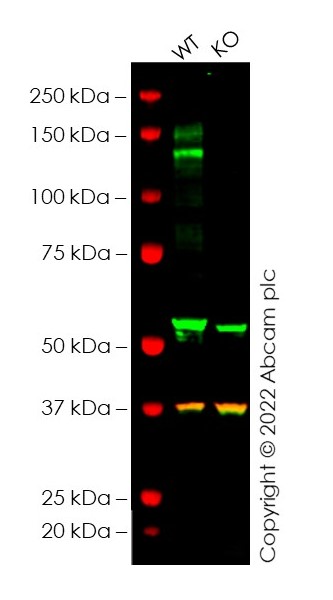 Western blot - Anti-Flt3 / CD135 antibody [EPR22232-318] - BSA and Azide free (AB245824)