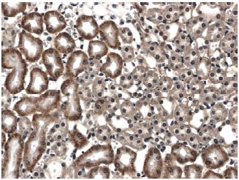 Immunohistochemistry (Formalin/PFA-fixed paraffin-embedded sections) - Anti-Flt3 / CD135 antibody [RM0021-12B6] (AB73019)
