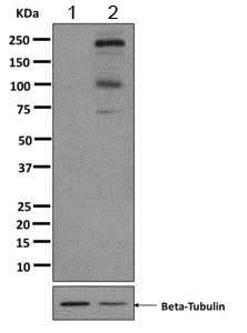 Western blot - Anti-Flt3 / CD135 (phospho Y589) antibody [EPR2311(2)] (AB171975)
