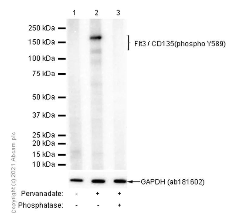 Western blot - Anti-Flt3 / CD135 (phospho Y589) antibody [EPR2311(2)] (AB171975)