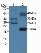 Western blot - Anti-Flt3 ligand/Flt3L antibody (AB231192), expandable thumbnail