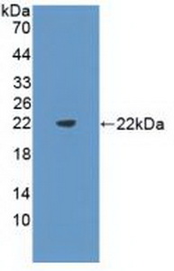 Western blot - Anti-Flt3 ligand/Flt3L antibody (AB231249), expandable thumbnail