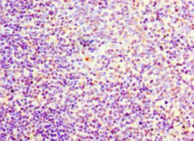 Immunohistochemistry (Formalin/PFA-fixed paraffin-embedded sections) - Anti-Flt3 ligand/Flt3L antibody (AB238610)