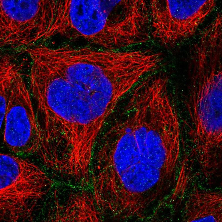 Immunocytochemistry/ Immunofluorescence - Anti-FLVCR1 antibody (AB251916)