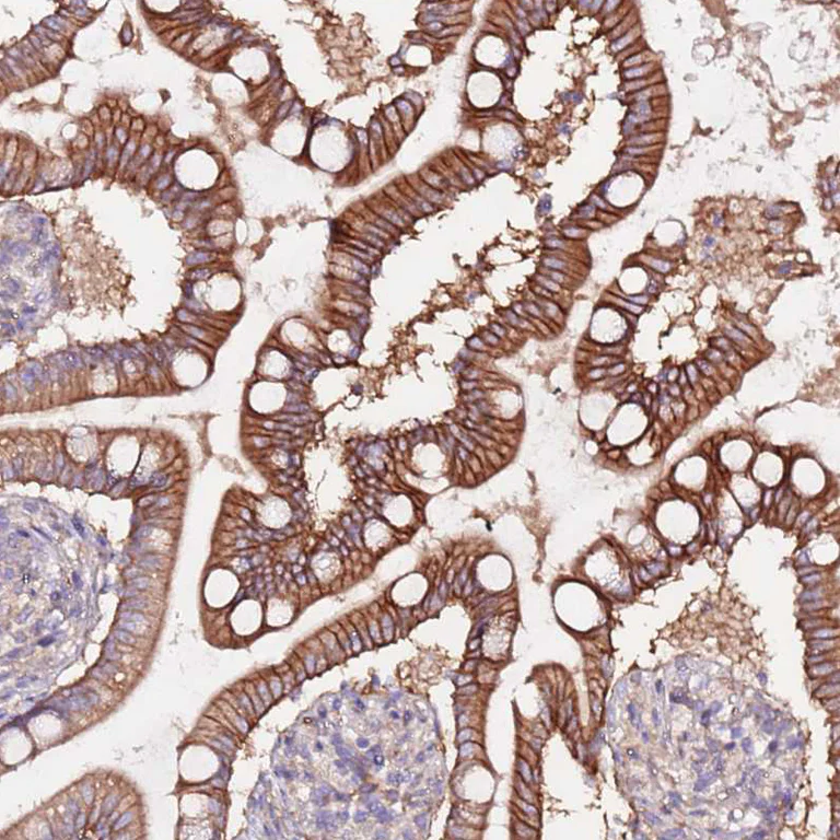 Immunohistochemistry (Formalin/PFA-fixed paraffin-embedded sections) - Anti-FLVCR1 antibody (AB251916)