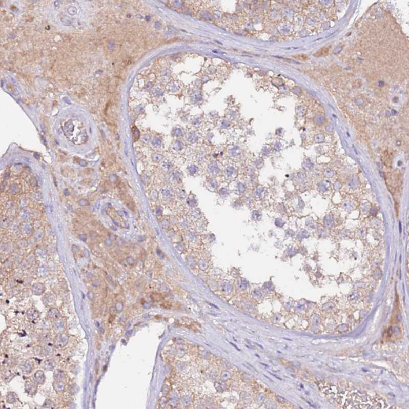 Immunohistochemistry (Formalin/PFA-fixed paraffin-embedded sections) - Anti-FLVCR1 antibody (AB251916)