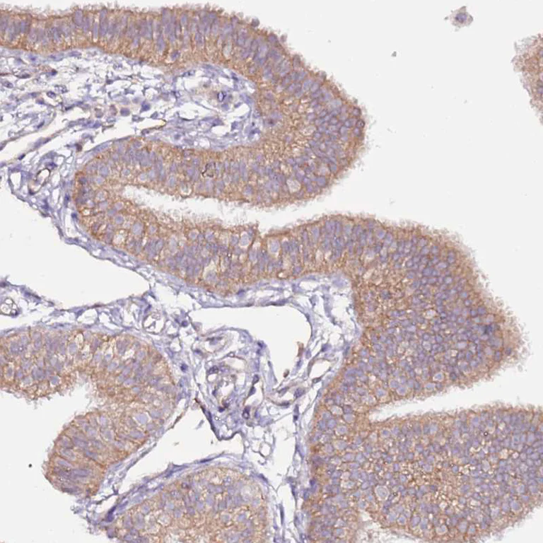 Immunohistochemistry (Formalin/PFA-fixed paraffin-embedded sections) - Anti-FLVCR1 antibody (AB251916)