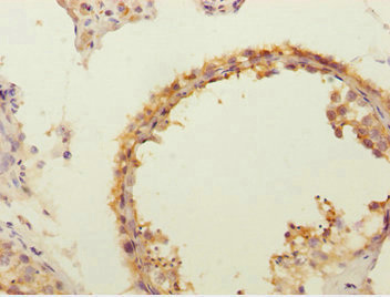 Immunohistochemistry (Formalin/PFA-fixed paraffin-embedded sections) - Anti-FLVCR2 antibody (AB234712)