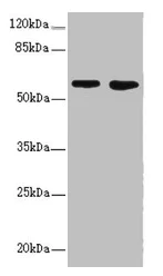 Western blot - Anti-FLVCR2 antibody (AB234712)
