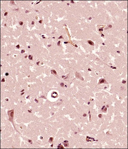 Immunohistochemistry (Formalin/PFA-fixed paraffin-embedded sections) - Anti-FMN2 antibody (AB72052)