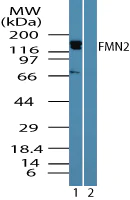 Western blot - Anti-FMN2 antibody (AB72052)