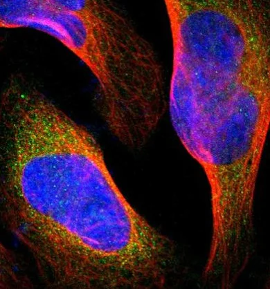 Immunocytochemistry/ Immunofluorescence - Anti-FMNL1 antibody (AB224247)