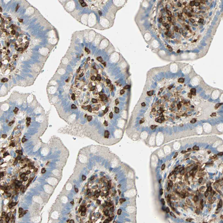 Immunohistochemistry (Formalin/PFA-fixed paraffin-embedded sections) - Anti-FMNL1 antibody (AB224247)