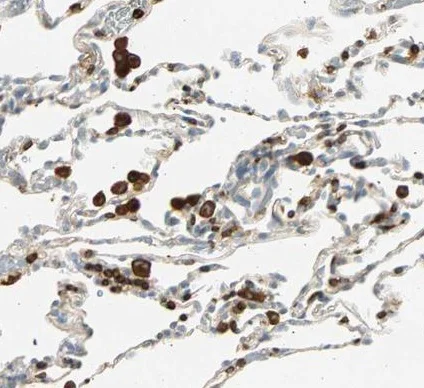 Immunohistochemistry (Formalin/PFA-fixed paraffin-embedded sections) - Anti-FMNL1 antibody (AB224247)