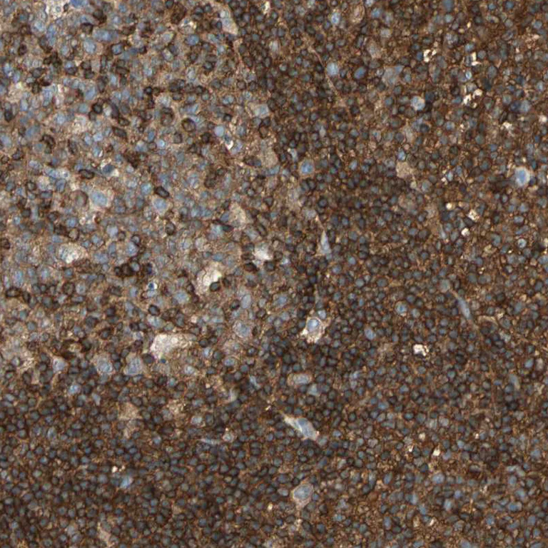 Immunohistochemistry (Formalin/PFA-fixed paraffin-embedded sections) - Anti-FMNL1 antibody (AB224247)