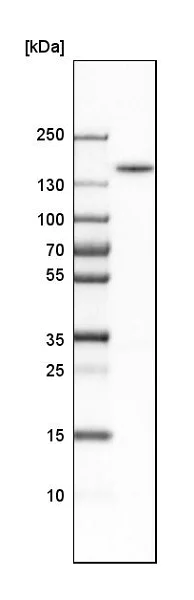 Western blot - Anti-FMNL1 antibody (AB224247)
