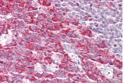 Immunohistochemistry (Formalin/PFA-fixed paraffin-embedded sections) - Anti-FMNL1 antibody - C-terminal (AB189940)