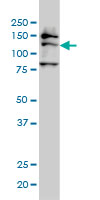 Western blot - Anti-FMNL2 antibody [2B4] (AB57963), expandable thumbnail