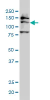 Western blot - Anti-FMNL2 antibody [2B4] (AB57963)