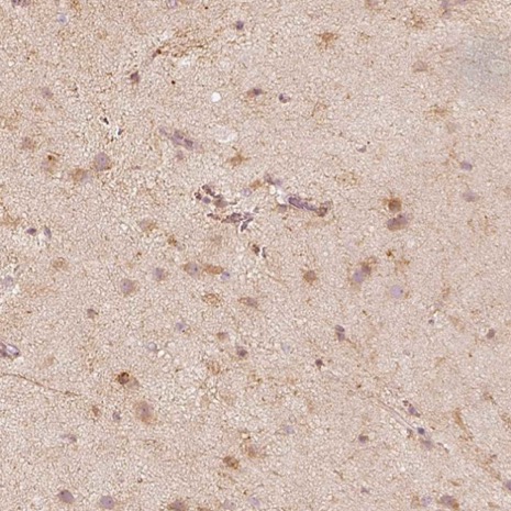 Immunohistochemistry (Formalin/PFA-fixed paraffin-embedded sections) - Anti-FMNL2 antibody (AB224338)