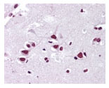 Immunohistochemistry (Formalin/PFA-fixed paraffin-embedded sections) - Anti-FMNL2 antibody (AB72105), expandable thumbnail