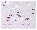 Immunohistochemistry (Formalin/PFA-fixed paraffin-embedded sections) - Anti-FMNL2 antibody (AB72105)