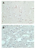 Immunohistochemistry (Formalin/PFA-fixed paraffin-embedded sections) - Anti-FMNL2 antibody (AB72105), expandable thumbnail