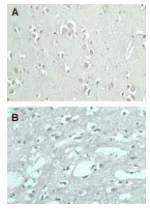 Immunohistochemistry (Formalin/PFA-fixed paraffin-embedded sections) - Anti-FMNL2 antibody (AB72105)
