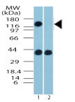 Western blot - Anti-FMNL2 antibody (AB72105), expandable thumbnail