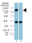 Western blot - Anti-FMNL2 antibody (AB72105)