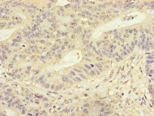 Immunohistochemistry (Formalin/PFA-fixed paraffin-embedded sections) - Anti-FMNL3 antibody (AB222797)