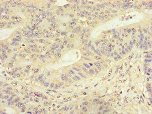Immunohistochemistry (Formalin/PFA-fixed paraffin-embedded sections) - Anti-FMNL3 antibody (AB222797)