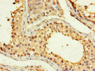Immunohistochemistry (Formalin/PFA-fixed paraffin-embedded sections) - Anti-FMNL3 antibody (AB222797)
