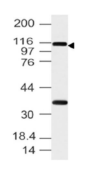 Western blot - Anti-FMNL3 antibody (AB224185), expandable thumbnail