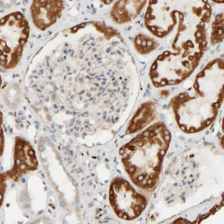 Immunohistochemistry (Formalin/PFA-fixed paraffin-embedded sections) - Anti-FMO1 antibody (AB224452)