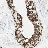 Immunohistochemistry (Formalin/PFA-fixed paraffin-embedded sections) - Anti-FMR1NB antibody (AB121339)