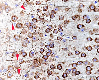 Immunohistochemistry (Formalin/PFA-fixed paraffin-embedded sections) - Anti-FMRP antibody (AB17722)