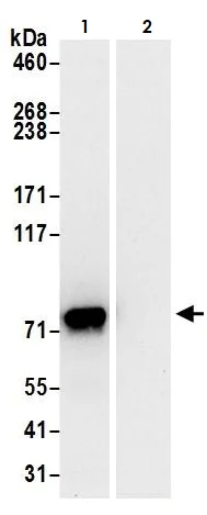 Immunoprecipitation - Anti-FMRP antibody (AB264380)