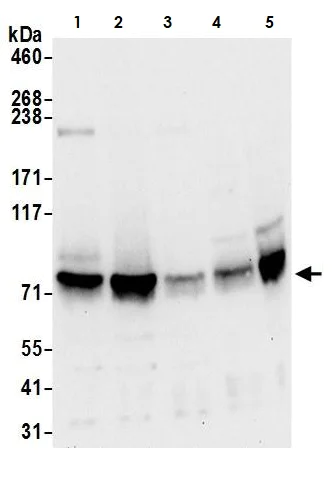Western blot - Anti-FMRP antibody (AB264380)
