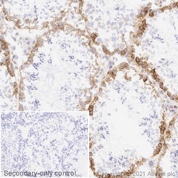 Immunohistochemistry (Frozen sections) - Anti-FMRP antibody [EPR23852-90] (ab259335), expandable thumbnail
