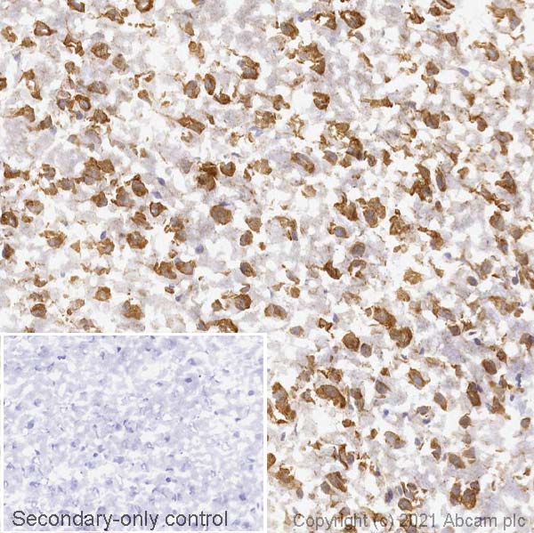 Immunohistochemistry (Frozen sections) - Anti-FMRP antibody [EPR23852-90] (ab259335), expandable thumbnail