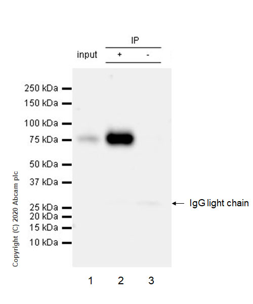Immunoprecipitation - Anti-FMRP antibody [EPR23852-90] (AB259335), expandable thumbnail