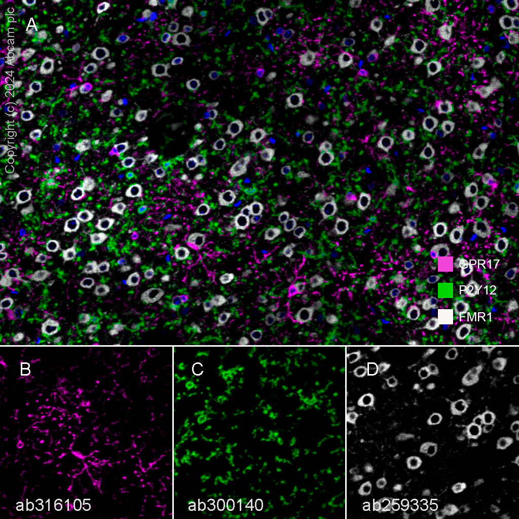 Multiplex immunohistochemistry - Anti-FMRP antibody [EPR23852-90] (ab259335), expandable thumbnail