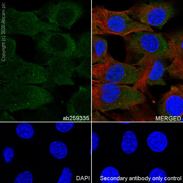 Immunocytochemistry/ Immunofluorescence - Anti-FMRP antibody [EPR23852-90] - BSA and Azide free (AB277489)