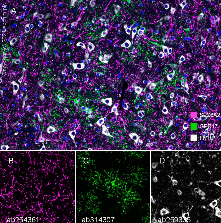 Multiplex immunohistochemistry - Anti-FMRP antibody [EPR23852-90] - BSA and Azide free (AB277489)