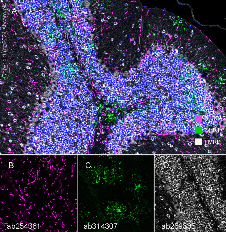 Multiplex immunohistochemistry - Anti-FMRP antibody [EPR23852-90] - BSA and Azide free (AB277489)