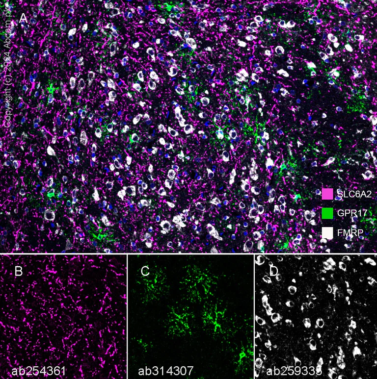 Multiplex immunohistochemistry - Anti-FMRP antibody [EPR23852-90] - BSA and Azide free (AB277489)