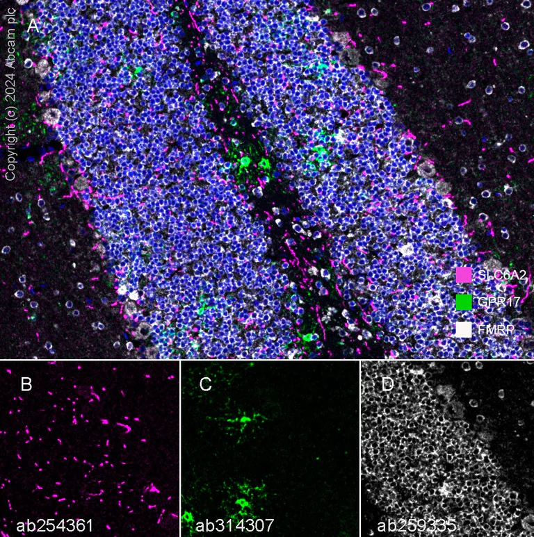 Multiplex immunohistochemistry - Anti-FMRP antibody [EPR23852-90] - BSA and Azide free (AB277489)